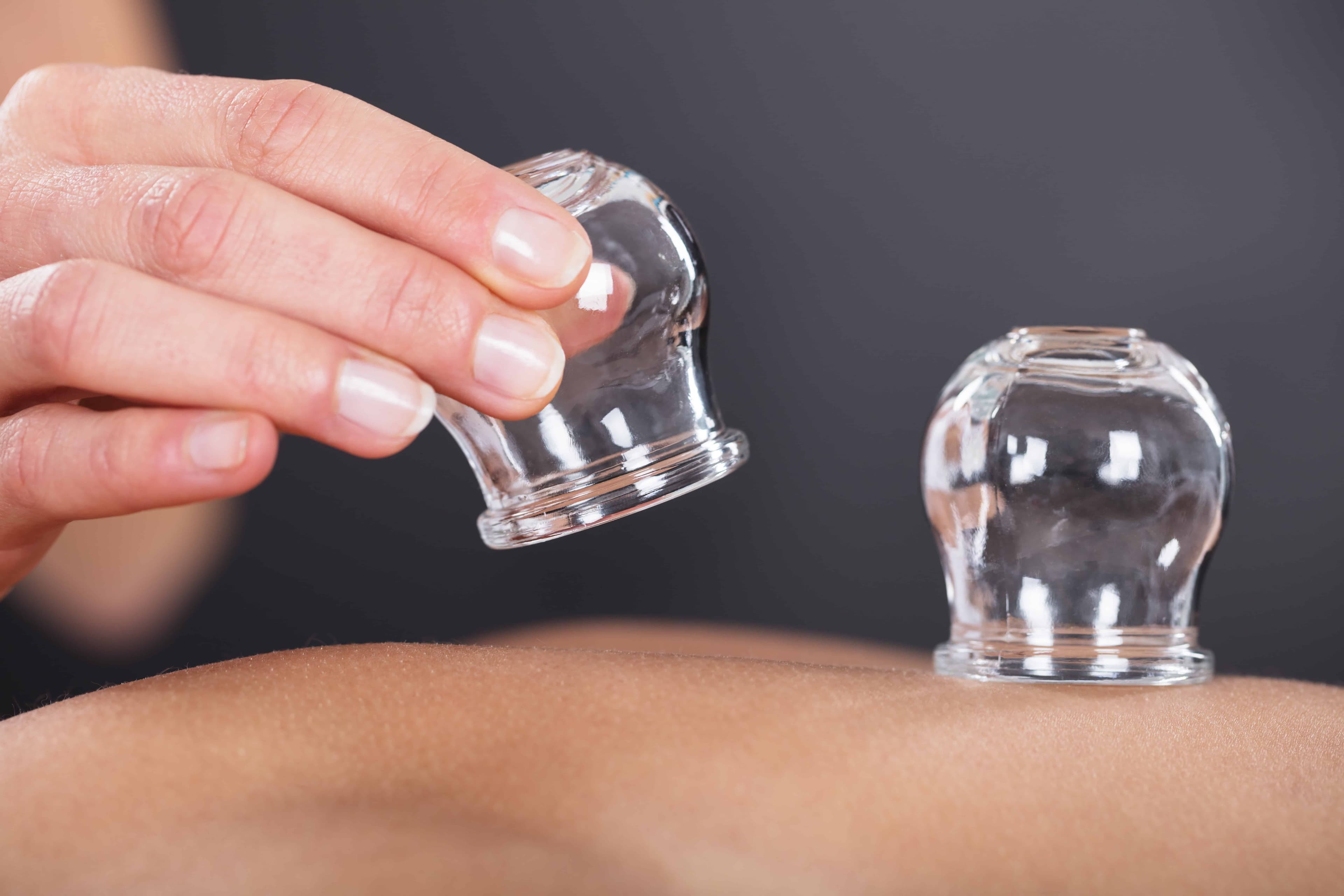 Cupping Therapy for Muscle Tension: What to Expect and When It Helps